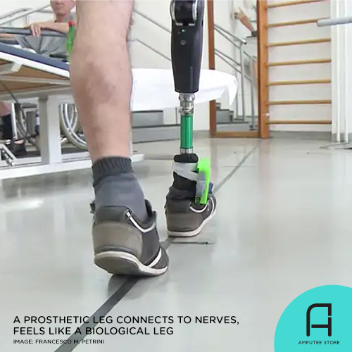 New amputation surgery makes prosthetic foot feel like the real thing