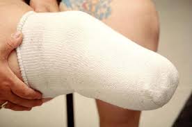 Best practices for applying stump socks.