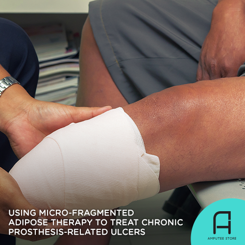 Chronic prosthesis-related ulcers can be treated using adipose tissue therapy.