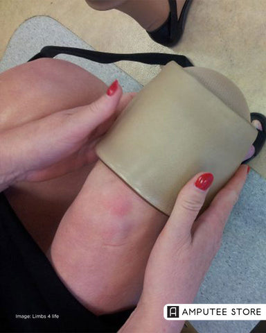 Why Your Prosthetic Liner Itches in Winter and How to Fix It