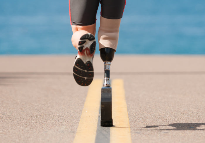 Scar Prothesis 5 Realities of Your Suture Scar Post Amputation | Amputee Store