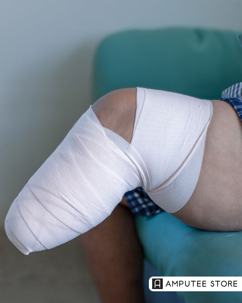 Neuros Medical prepares for the U.S. launch of Altius, a non-invasive, on-demand treatment for post-amputation pain.