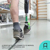 A prosthetic leg that connects to nerves moves and feels like a biological leg.