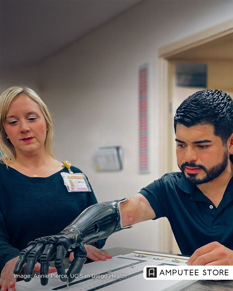 Bionic Hand Restores Strength to Electrocution Survivor – Amputee Store