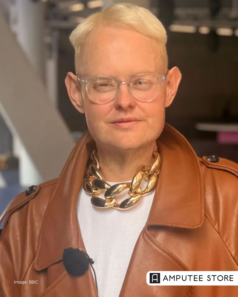 Michael Hopkinson, a bilateral below-knee amputee and model, speaks about embracing prosthetics and building body confidence.