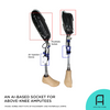 Korean researchers recently developed an AI-based prosthetic socket for above-knee amputees.