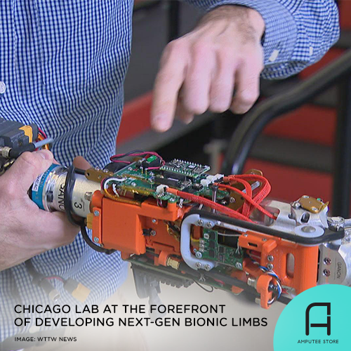 Chicago Lab at the Forefront of Developing Next-Gen Bionic Limbs ...