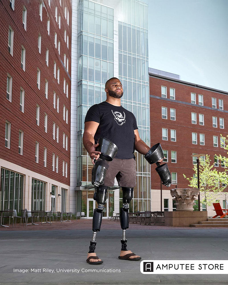 Brian Douglas, a bilateral lower limb amputee, stands outside a university building wearing prosthetic legs and holding another pair of prostheses in both hands.