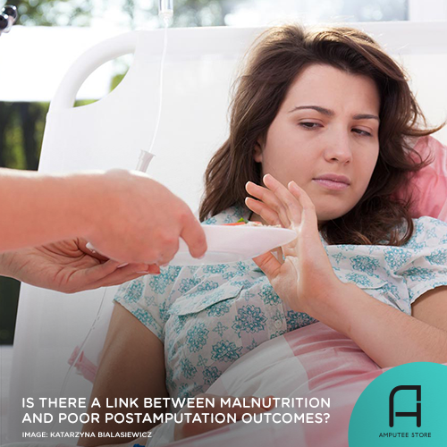 Possible link between pre-amputation malnutrition and poor post-amputation outcomes.