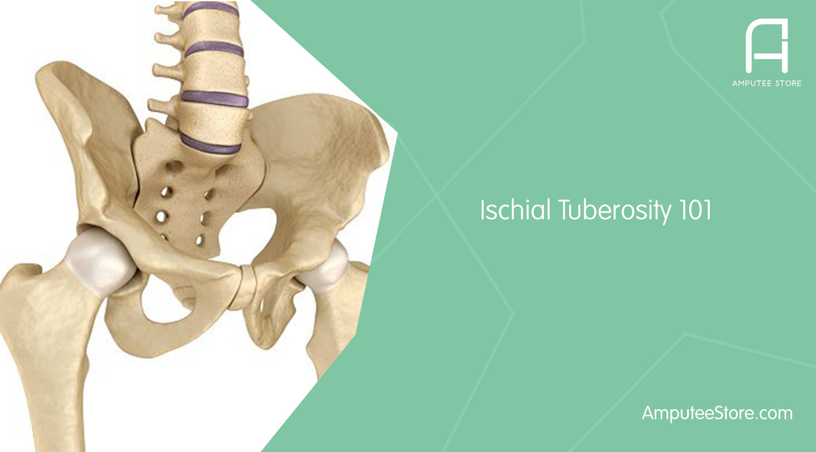 Your ischial tuberosity is a bone within the pelvis that supports your body weight when wearing an aka prosthesis.