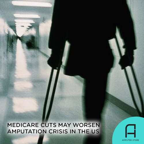 Medicare's 2022 cuts may worsen the amputation crisis in the US.