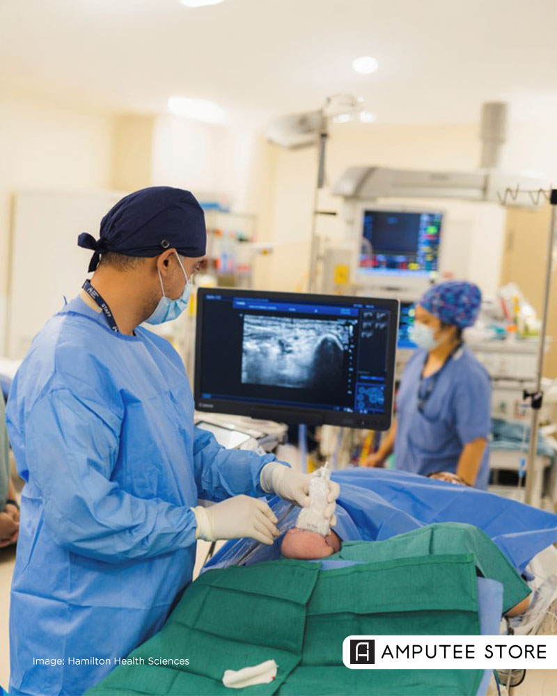 Clinician performs ultrasound-guided cryoablation on a residual limb to treat neuroma pain after amputation.