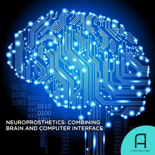 Brain-computer interfaces and artificial intelligence mean better neuroprosthetics.