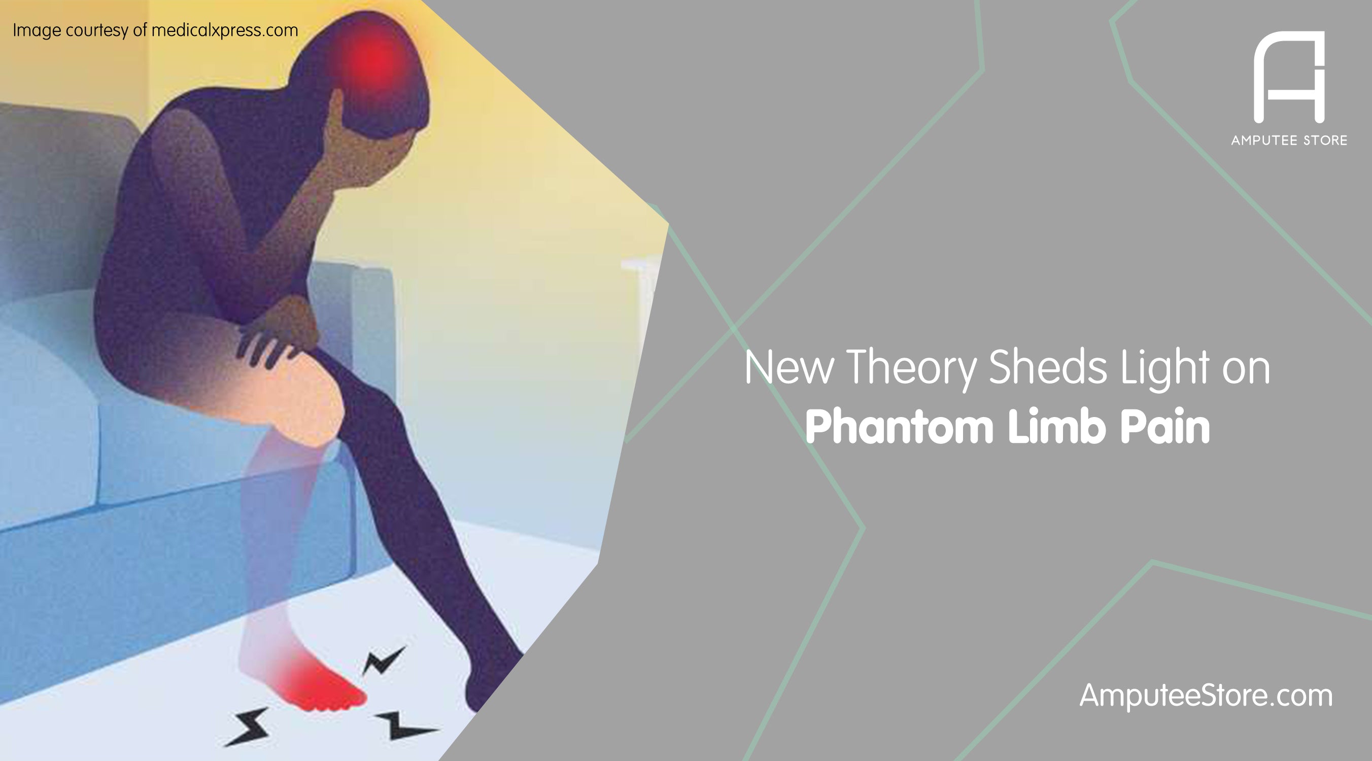 Phantom limb pain after all of these years has yet to be solved.