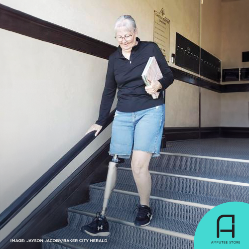 Osseointegration gives above-knee amputee a new lease on life.