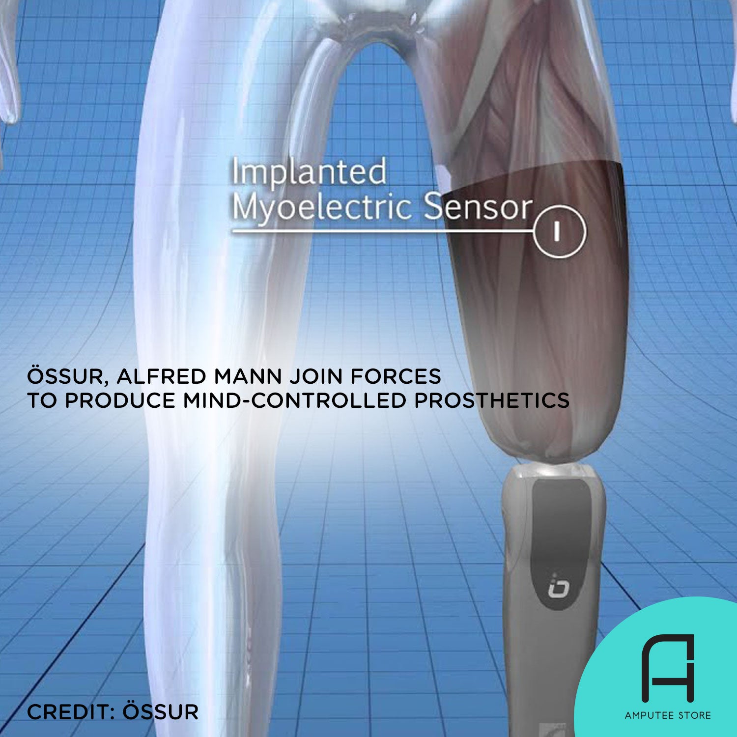 Össur, is one step closer to bringing mind-controlled prosthetics to the market.