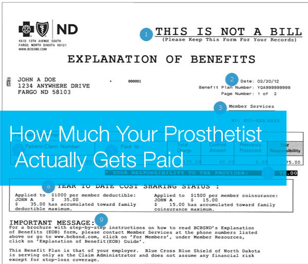 How much will your health insurance cover for prosthetic services.