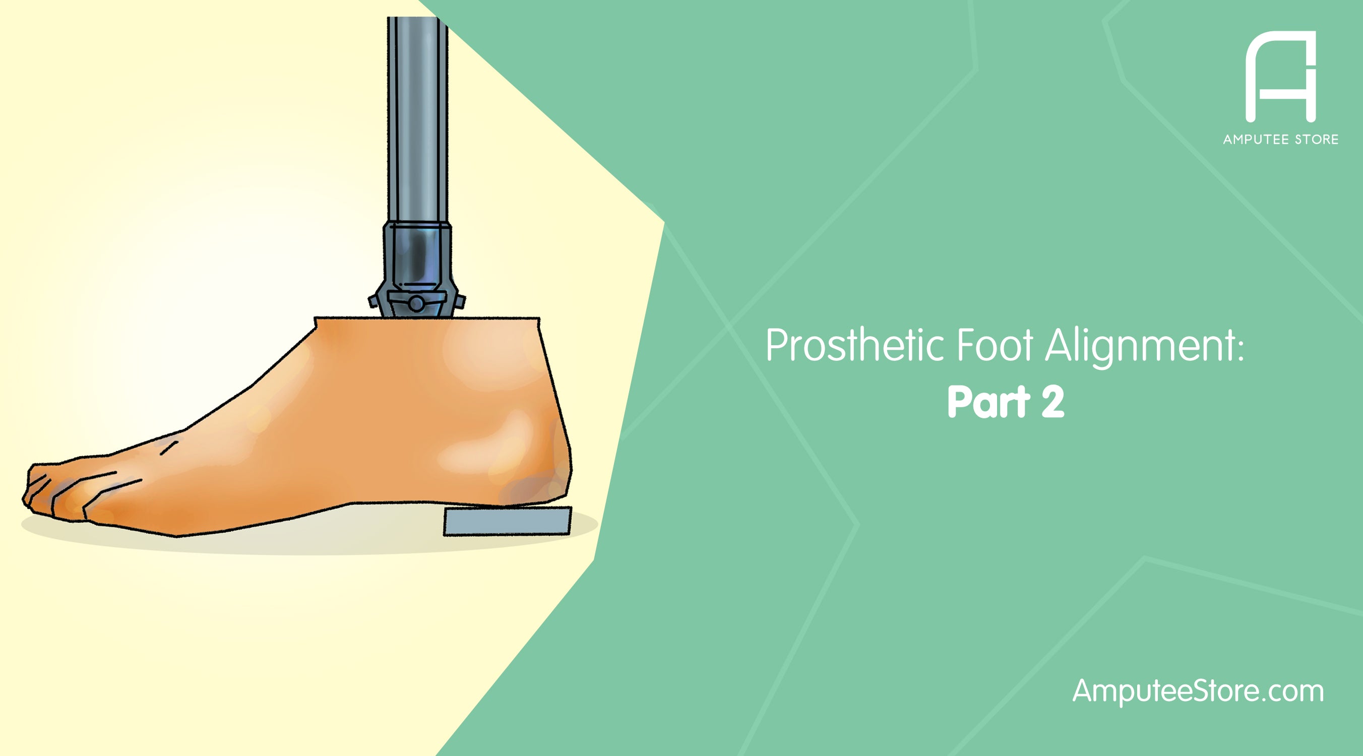 Everything you need to know about prosthetic foot alignment part 2