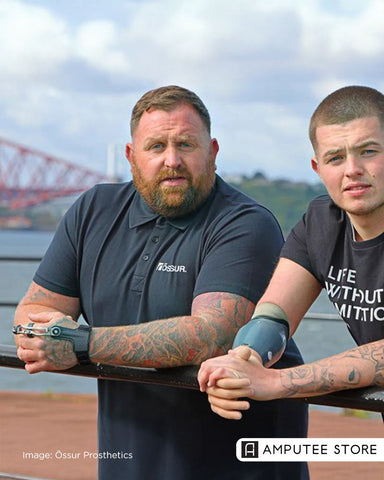 Prosthetics Bring New Possibilities to Dunfermline Father and Son