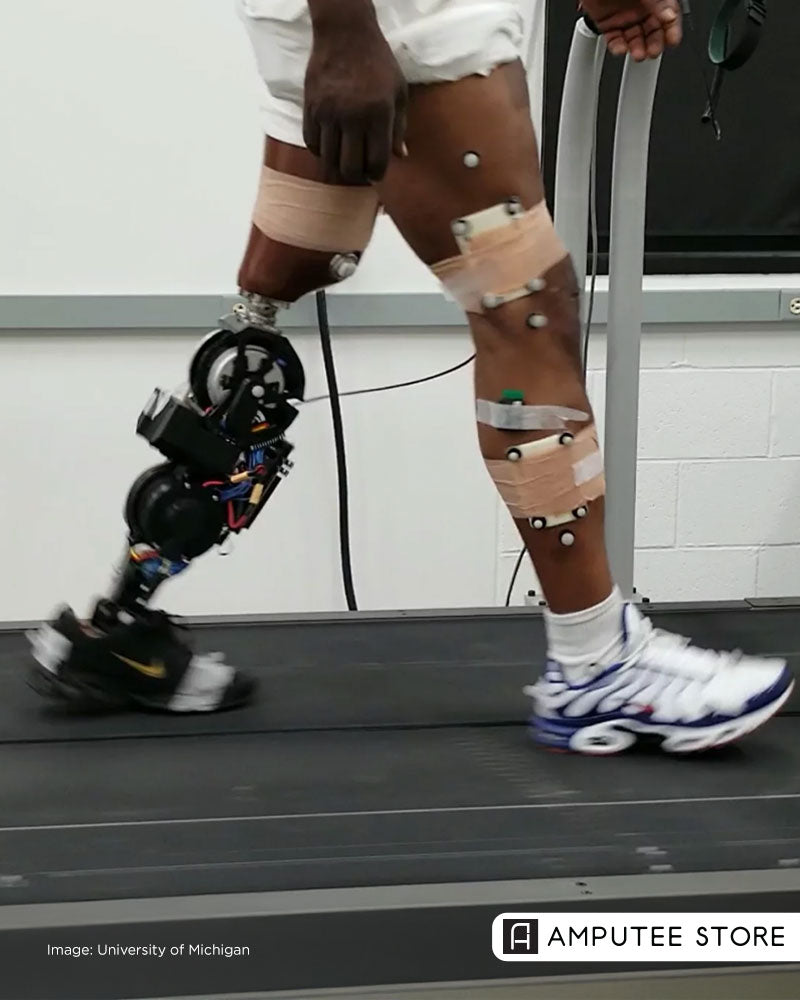 Robotic prosthetic leg user walking on a treadmill with motion sensors during gait research, illustrating prosthetic gait perception, mobility confidence, robotic leg adaptation, and amputee rehabilitation.
