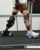 Robotic prosthetic leg user walking on a treadmill with motion sensors during gait research, illustrating prosthetic gait perception, mobility confidence, robotic leg adaptation, and amputee rehabilitation.
