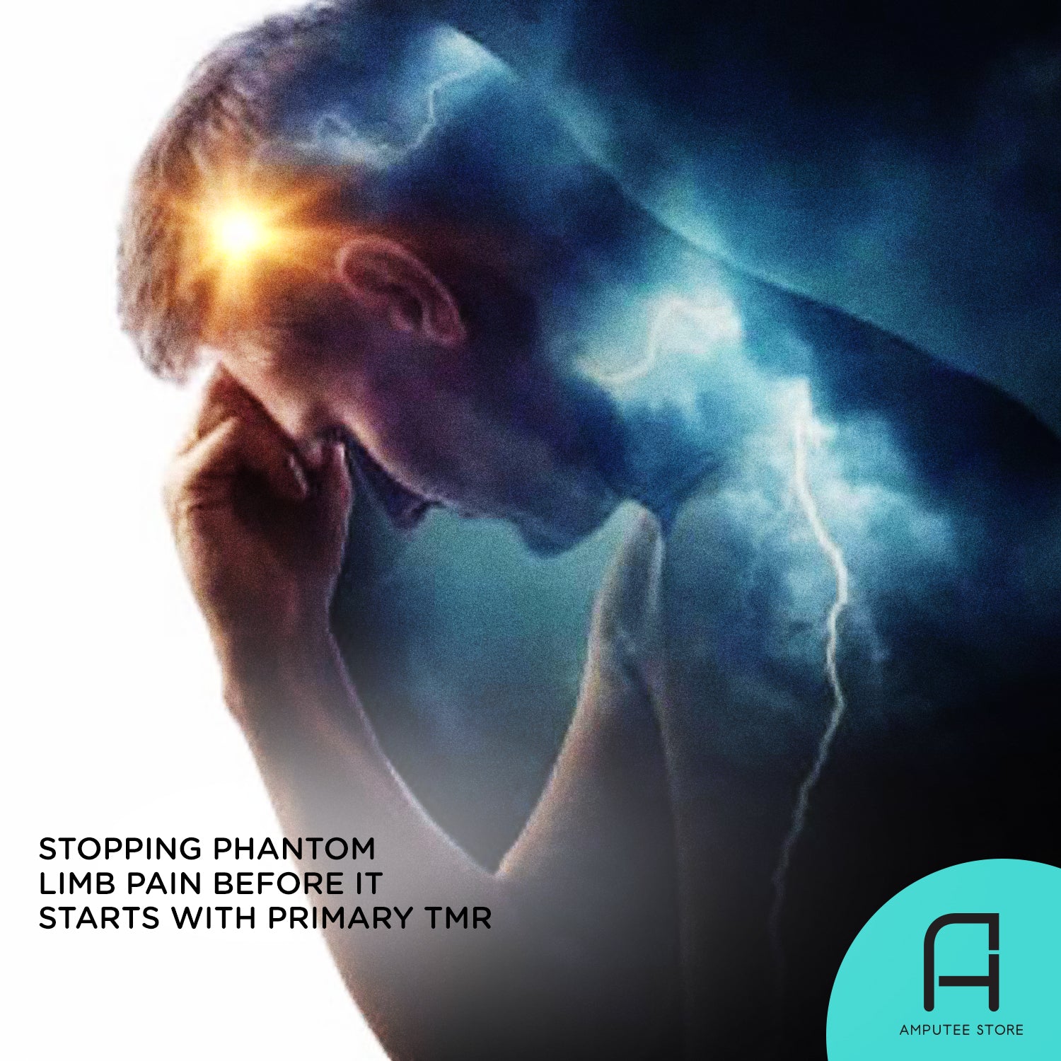 Man suffering from phantom limb pain, which could be stopped before it starts with primary TMR.