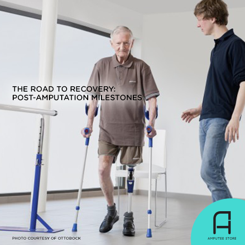 Watch out for these post-amputation milestones that are reliable signs of progress in your road to recovery. 