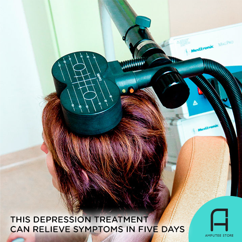This new rTMS depression treatment can relieve symptoms in five days.