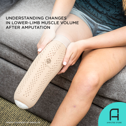 Understanding Changes in Lower-Limb Muscle Volume After Amputation