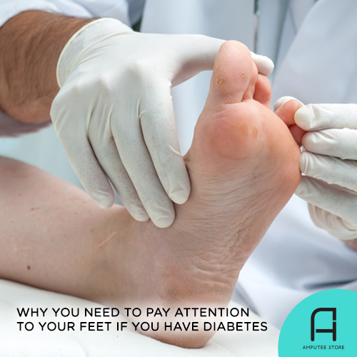 Include a thorough examination of your feet in your daily routine especially if you have diabetes.