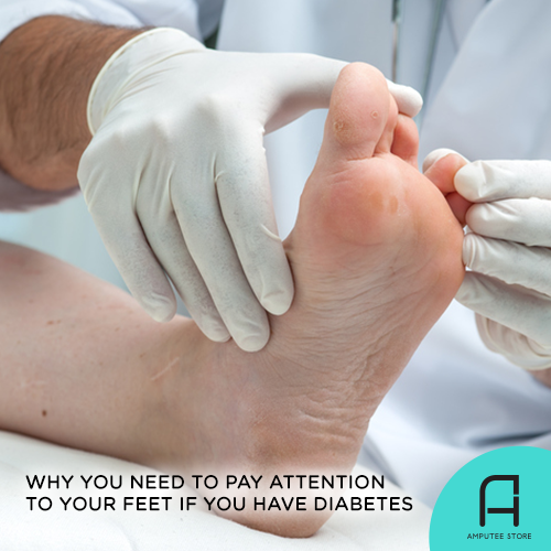 If You Have Diabetes, Pay Attention to Your Feet | Amputee Store