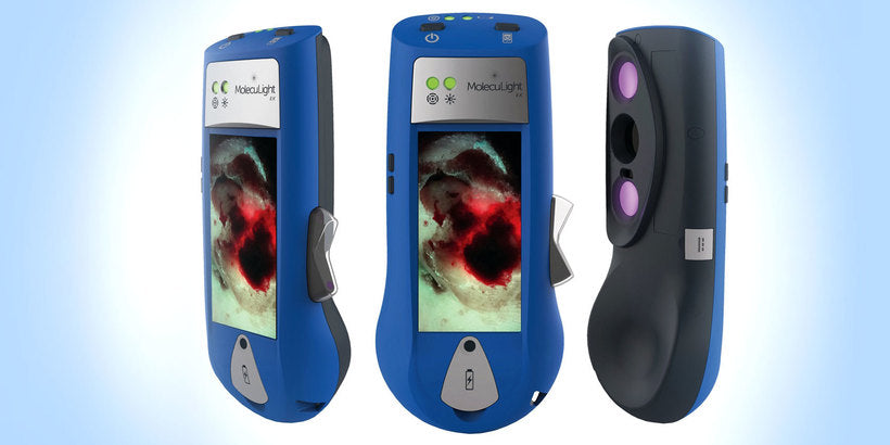 How Technology Aids in Smarter Wound Care